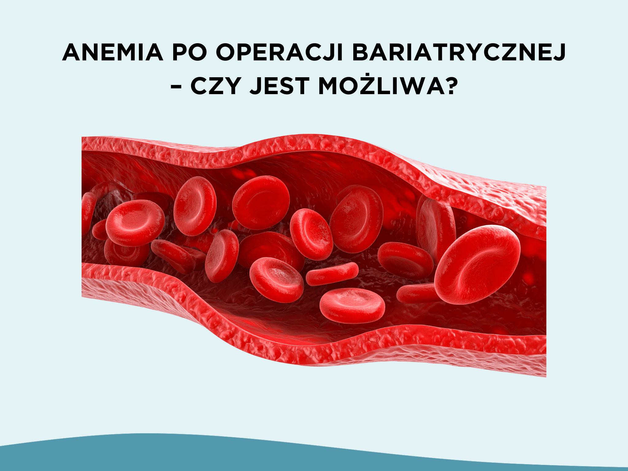 Anemia po operacji bariatrycznej – czy jest możliwa?