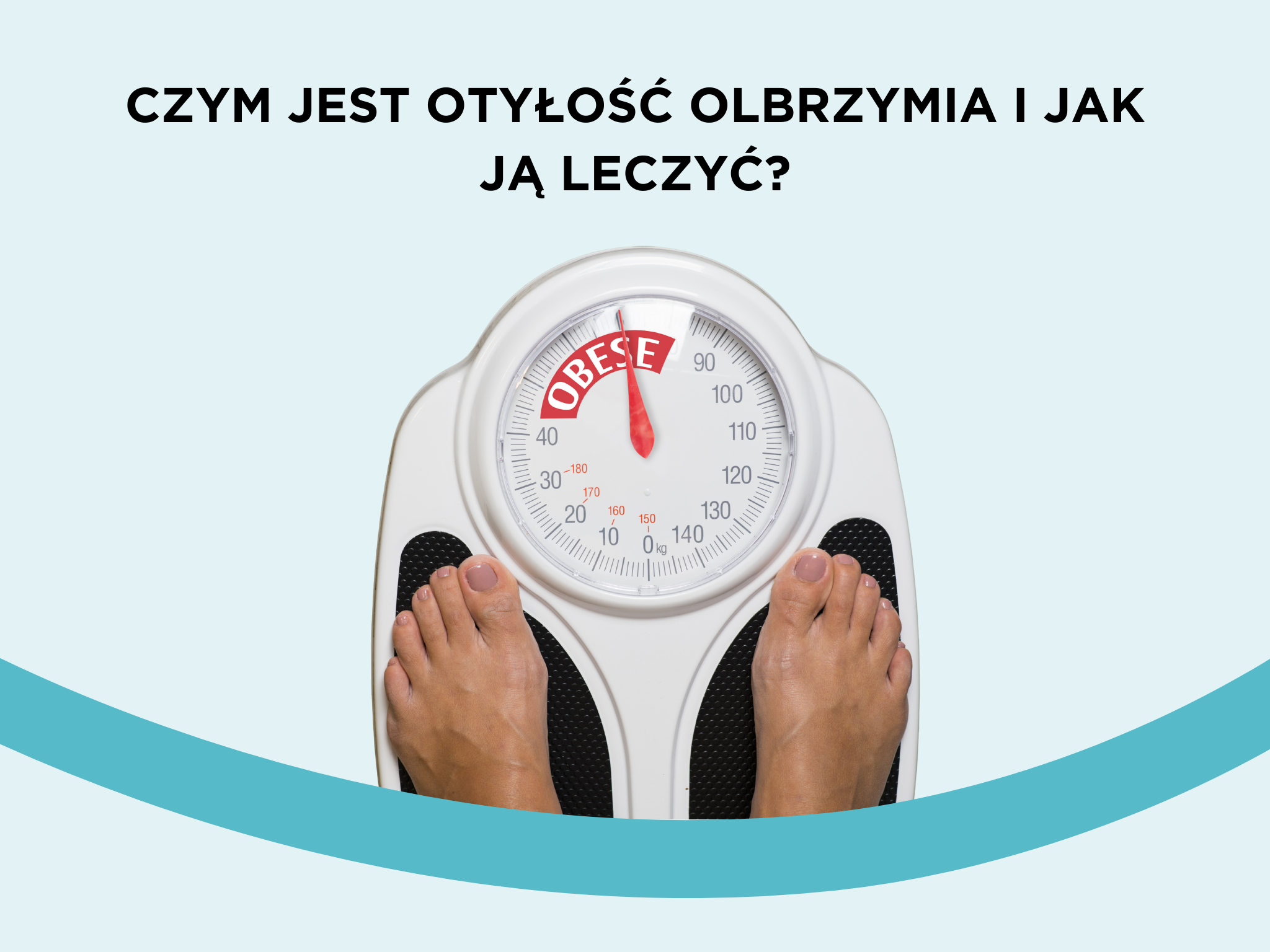 Czym jest otyłość olbrzymia i jak ją leczyć?