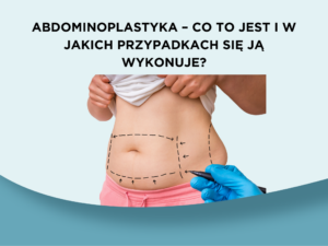 Abdominoplastyka – co to jest i w jakich przypadkach się ją wykonuje?