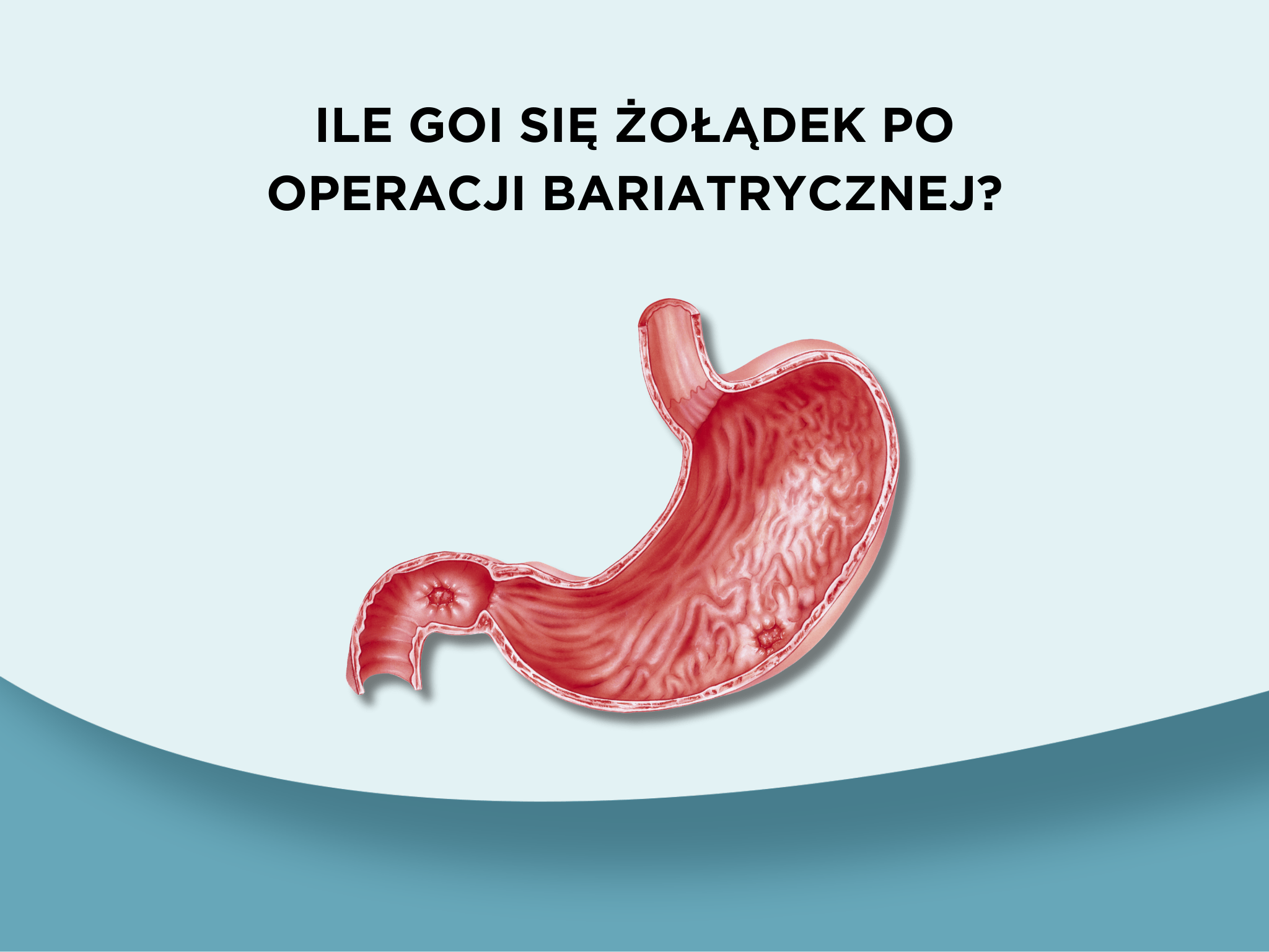 Ile goi się żołądek po operacji bariatrycznej?