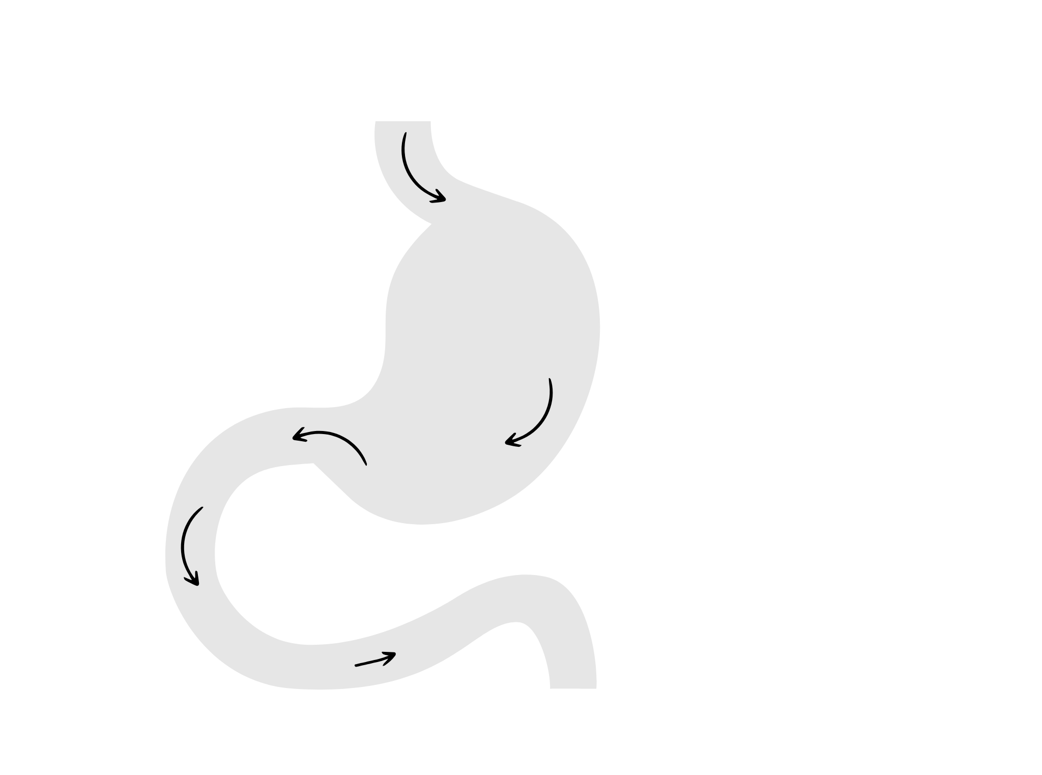 SADI-S - przed zabiegiem