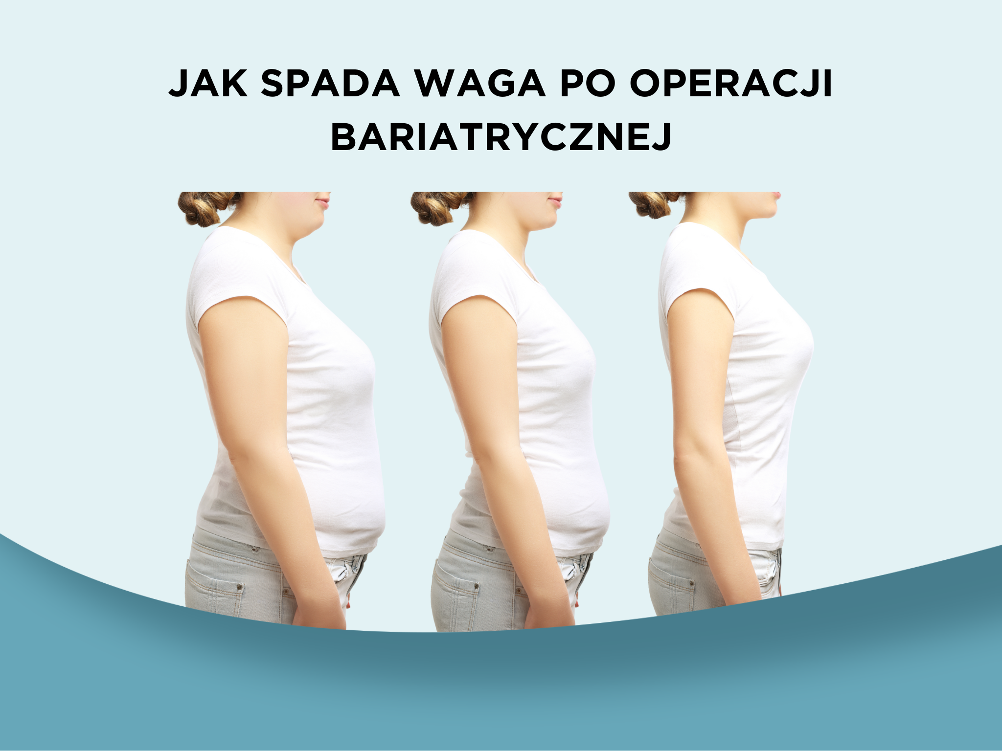 Jak spada waga po operacji bariatrycznej?