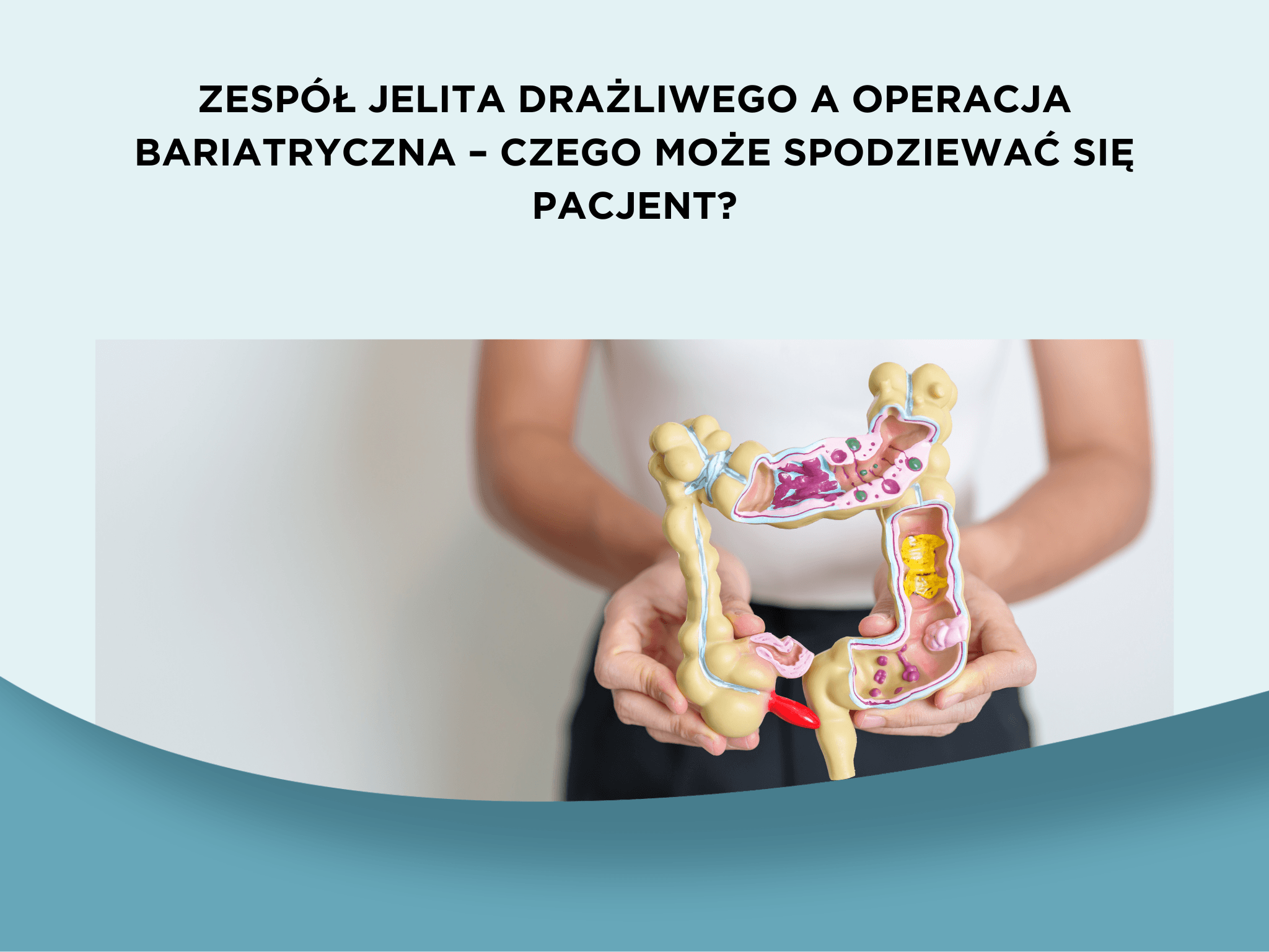 Zespół jelita drażliwego a operacja bariatryczna – czego może spodziewać się pacjent?