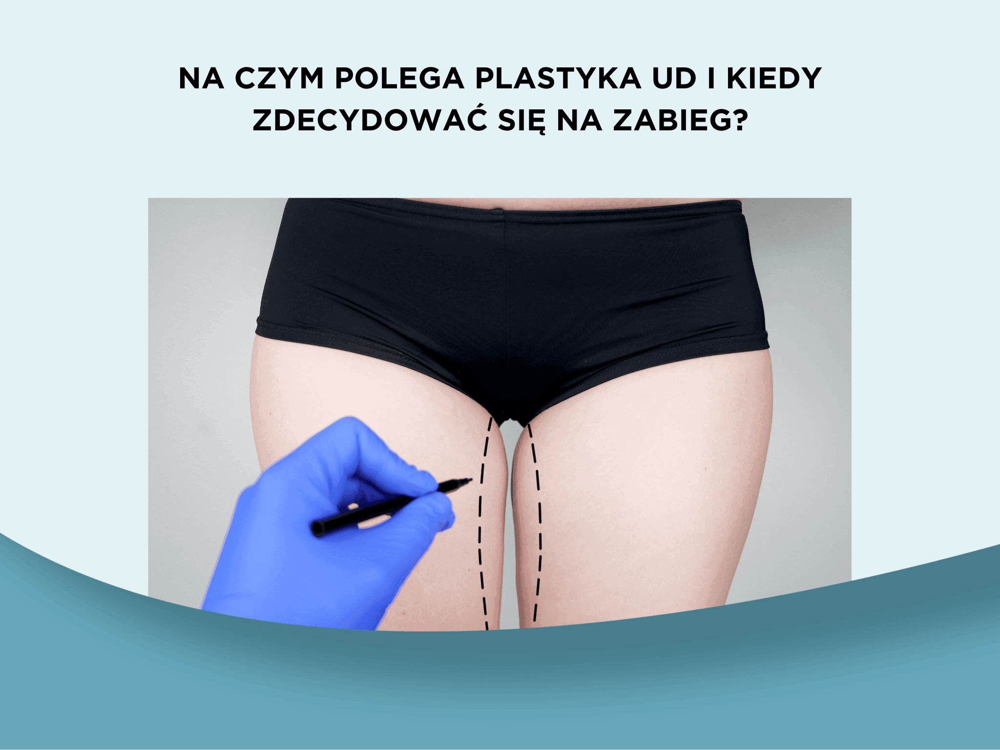 Na czym polega plastyka ud i kiedy zdecydować się na zabieg?